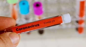 В Україні немає підтверджених випадків коронавірусу – МОЗ