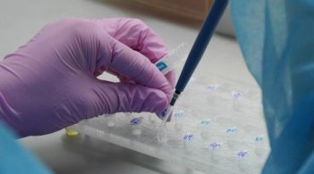 Київ отримав швидкі тести для діагностики COVID-19