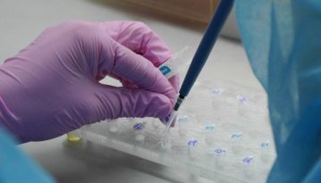 Київ отримав швидкі тести для діагностики COVID-19