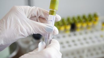 РФ хоче відправити на окупований Донбас хворого на коронавірус – розвідка ООС