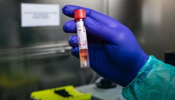 У Вінницькій області зафіксували перший випадок коронавірусу