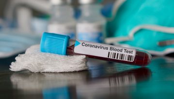 В Україні зафіксували 480 випадків коронавірусу, 11 – летальних