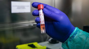 В Україні зафіксовано 311 нових випадків коронавірусу, усього інфіковано 2203 особи