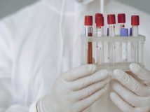 Світовий банк виділив Україні 135 млн доларів на поліпшення системи охорони здоров'я
