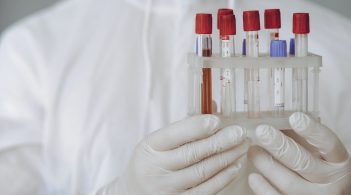 Світовий банк виділив Україні 135 млн доларів на поліпшення системи охорони здоров'я