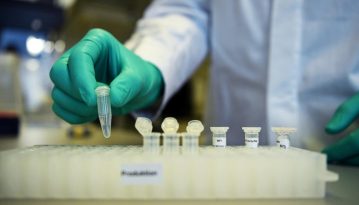 ​В Україні зафіксовано 504 нових випадків коронавірусу